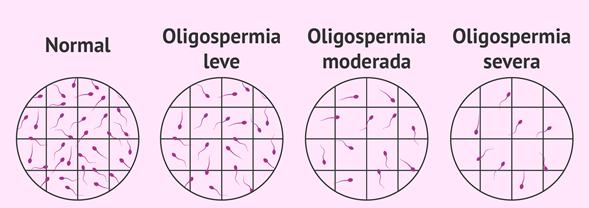 La eyaculacion diaria podria afectar la calidad del esperma
