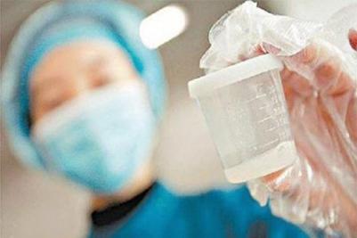 La eyaculacion diaria podria afectar la calidad del esperma