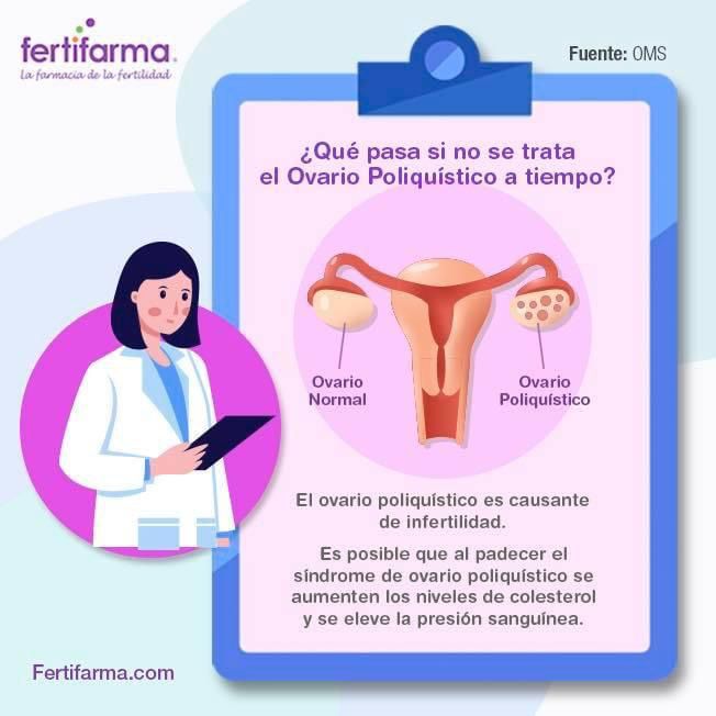 que pasa si no se trata el ovario poliquístico a tiempo