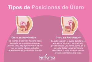 Útero en Anteversión. Causas, Síntomas y Tratamiento