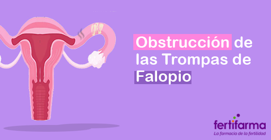 obstrucción de las trompas de falopio